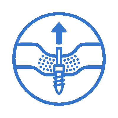 elevación sinual crestal elevación sinusal crestal