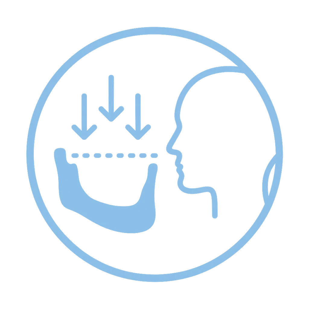 Atrofia Osea severa atrofia osea severa